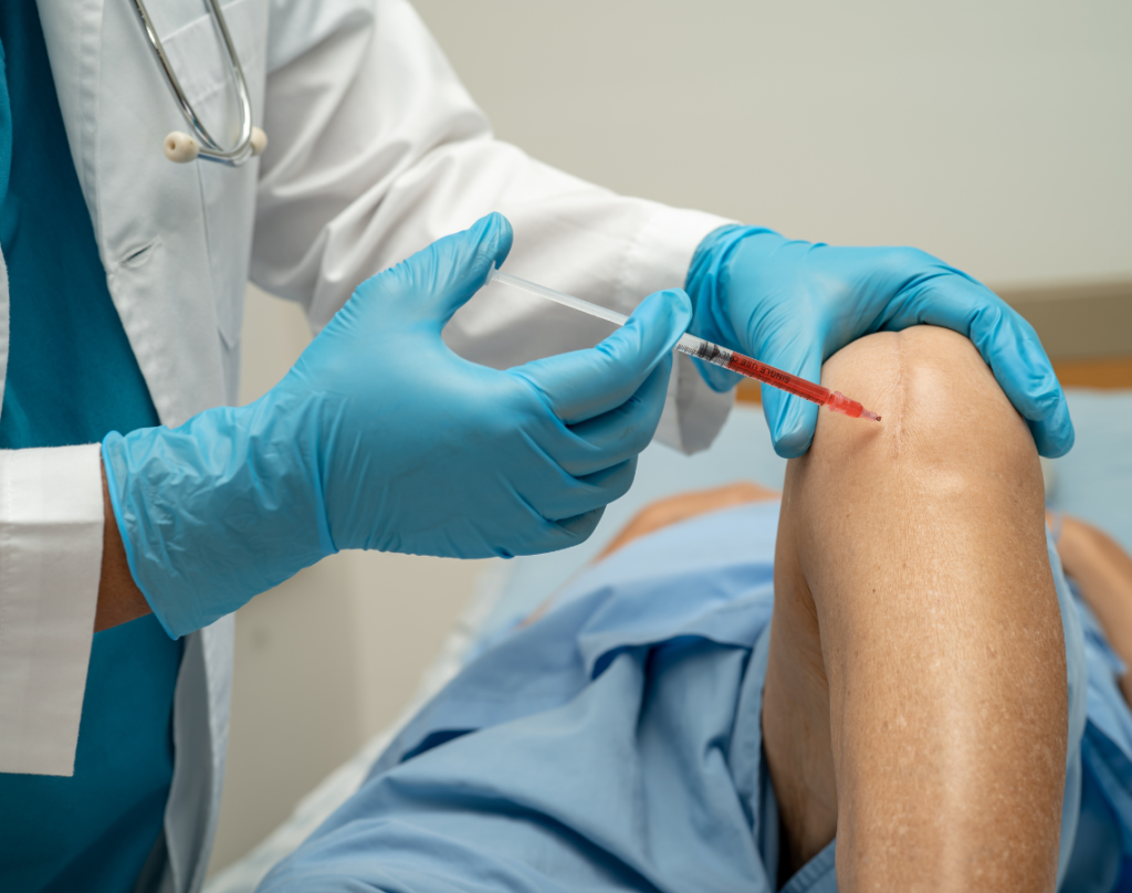 Tratamiento PRP Plus con exosomas en Bogotá